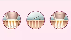 Fotoepiliatorius Philips Lumea Prestige IPL 8000 Series BRI945/00 aprašymas - Prekės nuotrauka