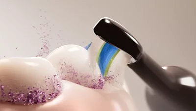 Elektrinis dantų šepetėlis Philips Philips Sonicare 3100 HX4033/32, juodas (Pažeista pakuotė) aprašymas - Prekės nuotrauka