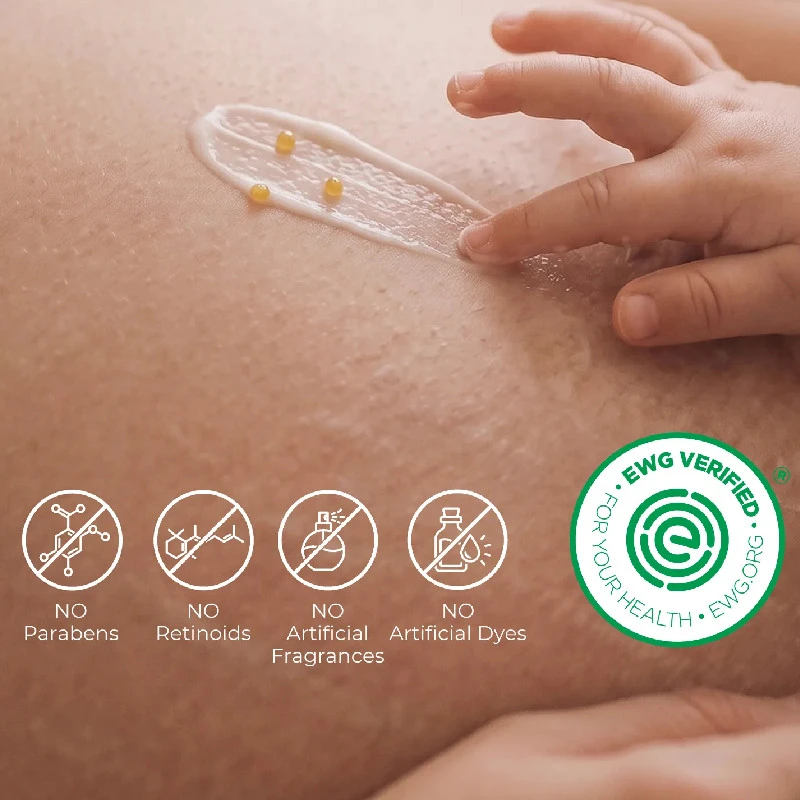 MOMCOZY STANGRINAMASIS KŪNO KREMAS NUO STRIJŲ SU KOLAGENU, 30 G