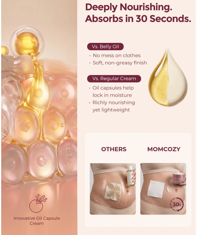 MOMCOZY STANGRINAMASIS KŪNO KREMAS NUO STRIJŲ SU KOLAGENU, 30 G