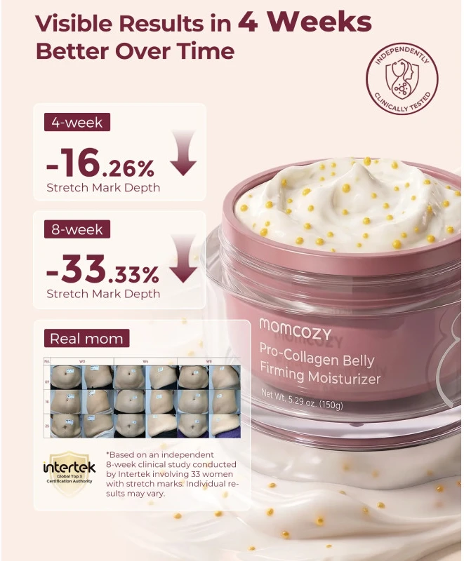 MOMCOZY STANGRINAMASIS KŪNO KREMAS NUO STRIJŲ SU KOLAGENU, 30 G