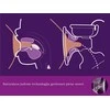 PHILIPS AVENT ELEKTRINIS PIENTRAUKIS SCF395