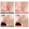 Naktinis serumas probleminei veido odai Mizon Goodbye Blemish Rožinė Spot Overnight, 19 ml