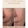 Shani Darden Lactic Acid šveičiamasis veido serumas su pieno rūgštimi, mini 5 ml