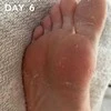 maskology FOOT PEEL Professional Foot Treatment nulupamoji pėdų kaukė-kojinės, 1 pora