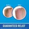 "O'keeffe's Healthy Feet" pėdų kremas 80ml