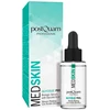 "Postquam Med Skin Biologic" serumas su glikolio rūgštimi 30ml