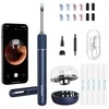 Smart Visual Ear-Clean Rod Bebird Note 5 pro - baltas