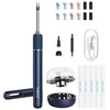 Smart Visual Ear-Clean Rod Bebird Note 5 pro (balta)