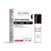 "Bella Aurora" intensyvi depigmentuojanti priemonė "Bio10 Forte" 30ml