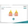 Assmann Electronic DIGITUS CAT 6 U-UTP pataisomasis kabelis PVC AWG 26/7 ilgis 1m geltona spalva