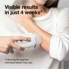 Braun IPL Silk·expert Pro 3 PL3230 Baltas