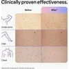 Fotoepiliatorius Braun Silk-Expert Pro IPL PL7253,  Intensyvaus pulso šviesa (IPL) „Rose Gold“, Balta