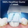 Oral-B iO Gentle Care dantų šepetėlio galvutė, 6 vnt.