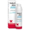 Help4Skin Hidrokoloidinis gelis nuo nudegimų, spartinantis jų gijimą, 75 g