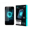 Xiaomi Redmi 4x Global - 3mk 1UP