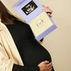 BIBS dovanų rinkinys „Baby on the Way Box“