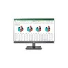 Monitorius LG 27UK670P-B – 27 colių | IPS | 4K UHD | 99 % sRGB | AMD FreeSync | USB-C | USB šakotuvas