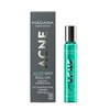 rutulinė priemonė nuo spuogų Madara Madara Acne Roll-On 8ml
