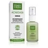 "Martiderm Acniover" serumas 30ml