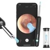 Smart Visual Ear-Clean strypas Bebird R1 juodas