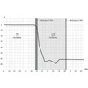 Filtras LTE 5G ekranuotas ALCAD RB-900 C48 0-694 MHz