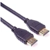 PremiumCord HDMI – HDMI kabelis 2m juodas (kphdm21-2)