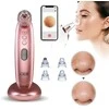 GESS SLEEK BLACKHEAD DULKUMINIS SUSIurbiklis SU KAMEROS