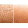 Beautifly B-Derma Glow Pro