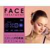 „BeautyRelax Beauty Relax Celluform Optimal“ estetinis prietaisas
