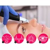 Beauty Relax BeautyRelax Ultrasonic spatula Peel &amp; Lift Premium BR-1540