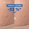 Mixa Stretch Mark Oil kūno aliejus nuo strijų, 100 ml