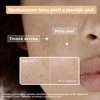 Mixa vitamino C + glikolio rūgšties serumas nuo tamsių dėmių odos serumas