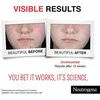 Neutrogena Clear &amp; Defend+ Daily Serum Skin Serum unisex, 30 ml