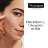 Neutrogena Patches for imperfections Sensitive Clear & Defend+ 30 pcs