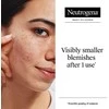 Neutrogena Clear &amp; Defend+