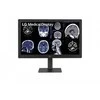 LG DIAGNOSTIC MONITORIUS, 31.5", 8MP, 1000CD/M2, SRGB100%, HAS, FRONT CALIBRATION SENSOR.