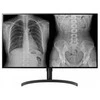 LG DIAGNOSTIC MONITORIUS, 31.5", 8MP, 450CD/M2, DCI-P3 98%, HAS/PIVOT.