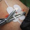 Rhino Rescue Wound Care Kit – Žaizdų užvėrimo rinkinys