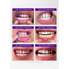 Dantų šepetėlis Hismile V34 Whitening Strips balinimo juostelės 14 vnt