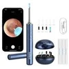 Smart Visual Ear-Clean Strypas Bebird M9 S (mėlynas)