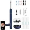 Smart Visual Ear-Clean Rod Bebird Note 5 pro (balta)