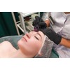 Soulima Derma Roller 0.5mm - needle mesotherapy