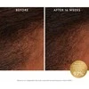 Moroccanoil Scalp Revitalizing Scalp Tonikas Hair Serum, 100 ml