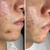ByTheQuality veido serumas su pieno rūgštimi ir probiotikais LactZe Serum