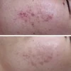 ByTheQuality vitamino C serumas Vitarect C15 Hybrid Ampoule