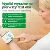 Medisana riešinis kraujospūdžio matuoklis BW 355 su pulso ir aritmijos indikatoriumi