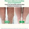 TESMED rankinis anticeliulitinis masažuoklis „Rose“, rožinis, plastikinis volas kūnui