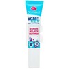 Dermacol AcneClear Vietinė priežiūra 15ml specializuota odos priežiūra Moterims