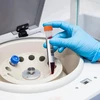 10 ml MĖGMENIS 40 Vnt. KŪGINIO PLASTIKO LABORATORIJA SU dangteliu